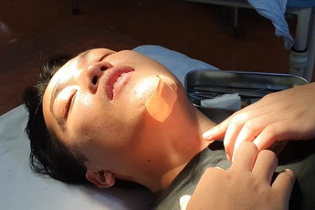 NTN đăng ảnh ngã dập cằm sau "tai nạn nghề nghiệp", cộng đồng mạng than thở: Tội anh quá