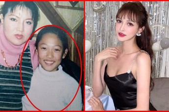 Hot girl từng dao kéo 300 lần bị dân mạng "đào mộ" loạt ảnh thuở niên thiếu khiến ai cũng ngỡ ngàng