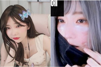Đang là hot girl vạn người mê, nữ streamer gây sốc khi công khai gương mặt biến dị, lý do khiến ai cũng bất ngờ