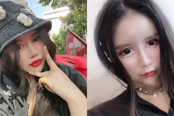 Phẫu thuật thẩm mỹ 100 lần trong 3 năm, cô gái bị bạn bè xa lánh vì "chẳng thể cười một cách tự nhiên"