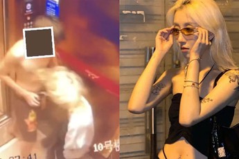 Công bố loạt ảnh bị bạn trai hành hung dã man, nàng hot girl khiến CĐM không khỏi chấn động