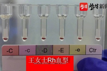 Phát hiện 2 người có nhóm "máu vàng" hiếm nhất trên thế giới tại Trung Quốc