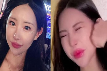 Từng thừa nhận can thiệp thẩm mỹ, nữ YouTuber vẫn tự tay "tác động vật lý" cực mạnh vào "mặt tiền" vì một điều