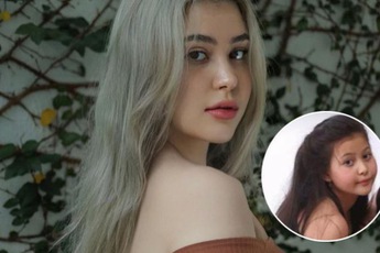 Sunna khoe ảnh xinh từ bé, làm rõ nghi vấn tiêm cằm