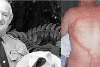 Người đàn ông giữ Kỷ lục Guinness thế giới vì 35 năm sét đánh 7 lần không mất mạng