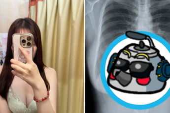 Khoe ảnh chụp X-quang vòng một, cô nàng streamer hút hơn 1,25 triệu lượt xem, CĐM dậy sóng chỉ trích