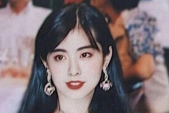 Gương mặt biến dạng thê thảm của mỹ nhân sở hữu nhan sắc "khiến cả thiên hạ quỳ phục"