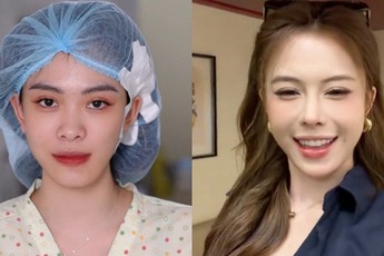 Hà Môi “đắp tiền lên mặt” để sửa những gì? Còn chiếc mũi “đang hếch dần và méo” giờ ra sao?
