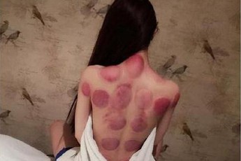 Game thủ chuyên nghiệp Trung Quốc "khốn khổ" vì bị tố đánh đập bạn gái