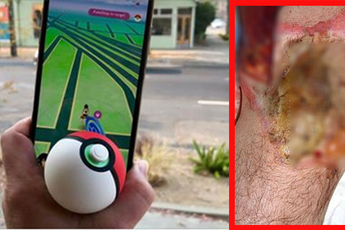 Truy tìm Pokemon, nam game thủ nhận phải chấn thương rùng rợn