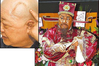 Trở thành triệu phú nhờ đóng Bao Công, Kim Siêu Quần về già không con cái, bệnh tật hành hạ