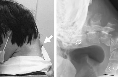 Những hình ảnh đáng sợ của việc chơi game không khoa học, cảnh báo cho game thủ