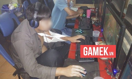 Bá đạo game thủ gãy xương vẫn ngồi chiến game như thường